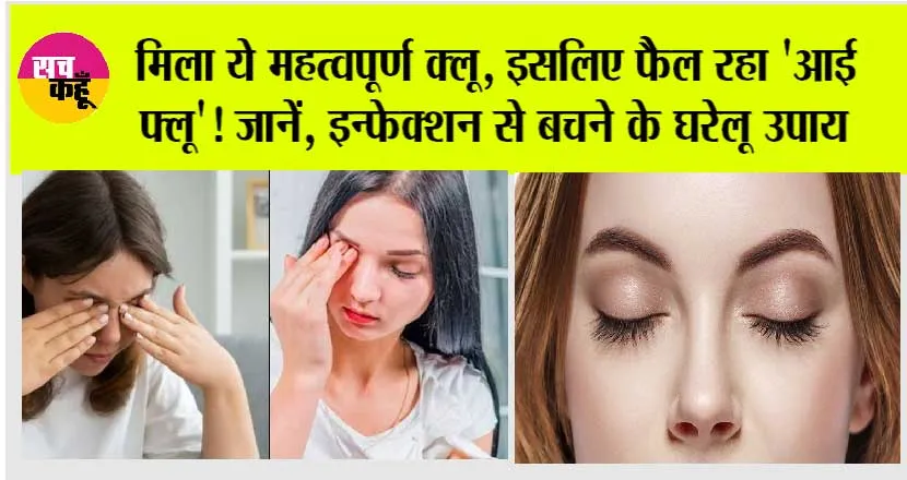 Eye Flu Home Remedy: मिला ये महत्वपूर्ण क्लू, इसलिए फैल रहा ‘आई फ्लू’! जानें, इन्फेक्शन से बचने के घरेलू उपाय