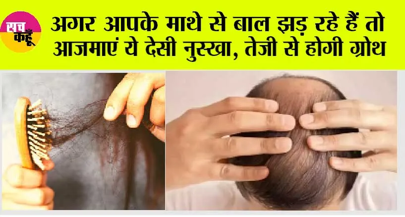 Hair Fall: अगर आपके माथे से बाल झड़ रहे हैं तो आजमाएं ये देसी नुस्खा, तेजी से आएंगे बाल