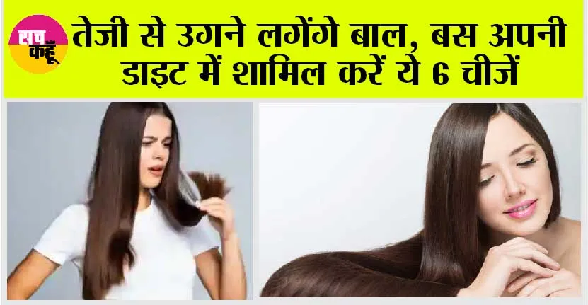 Hair Growth: तेजी से उगने लगेंगे बाल, ये 6 चीजें हैं कमाल, डाइट में करें आज से ही इस्तेमाल