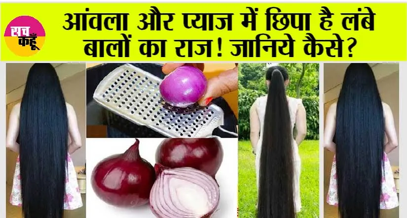 Hair Growth: आंवला और प्याज, इनमें छिपा है लंबे बालों का राज! जानिये कैसे?