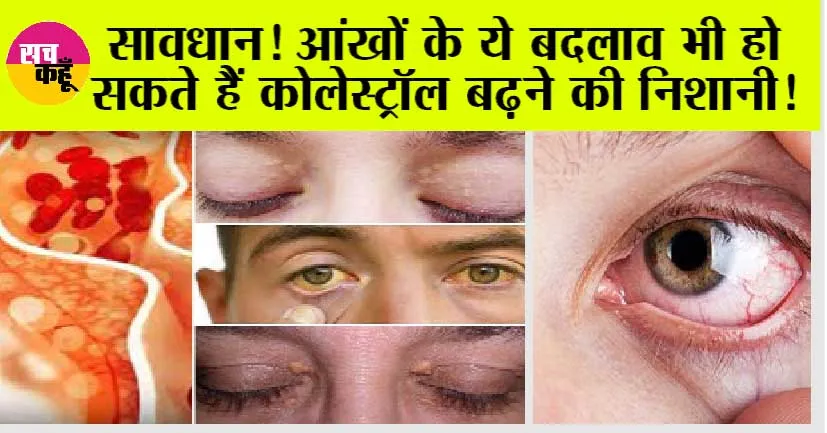 High Cholesterol Symptoms: आंखों की ऐसी रूपरेखा, ना करें अनदेखा, ऐसे परिवर्तन, हो सकते हैं कोलेस्ट्रॉल बढ़ने के लक्षण