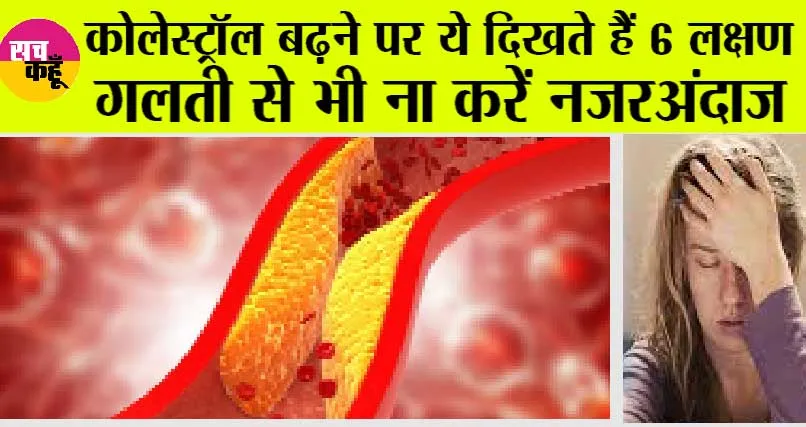 High Cholesterol: कोलेस्ट्रोल बढ़ने पर शरीर देता है ये संकेत, गलती से भी ना करें नजरअंदाज