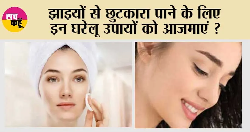 Home Remedies for Pigmentation: झाइयों से छुटकारा पाये सिर्फ़ 7 दिनों में !