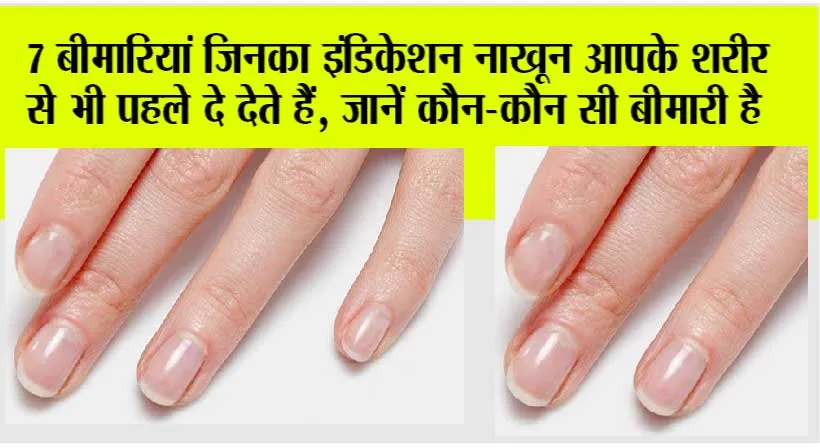 Nails Indication: आपके नाखून भी देते हैं बीमारी का संकेत, रंग देखकर जानें अपनी सेहत का हाल