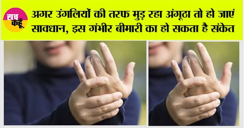 Psoriatic Arthritis: क्या आपके पैर का अंगूठा भी उंगलियों की तरफ मुड़ रहा तो हो जाएं सावधान, इस बीमारी का हो सकता है संकेत