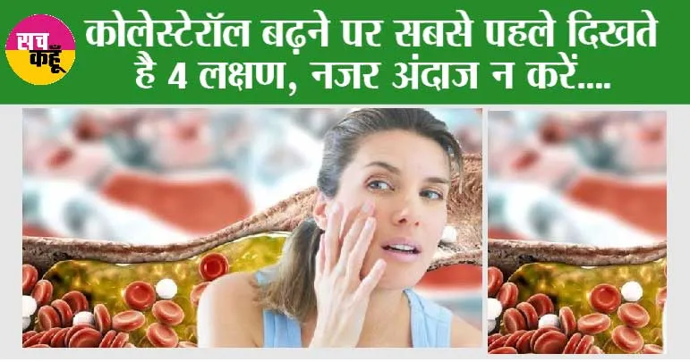Signs of High Cholesterol: कोलेस्टेरॉल बढ़ने पर सबसे पहले दिखते है 4 लक्षण, नजर अंदाज करने पर हो सकती है समस्या