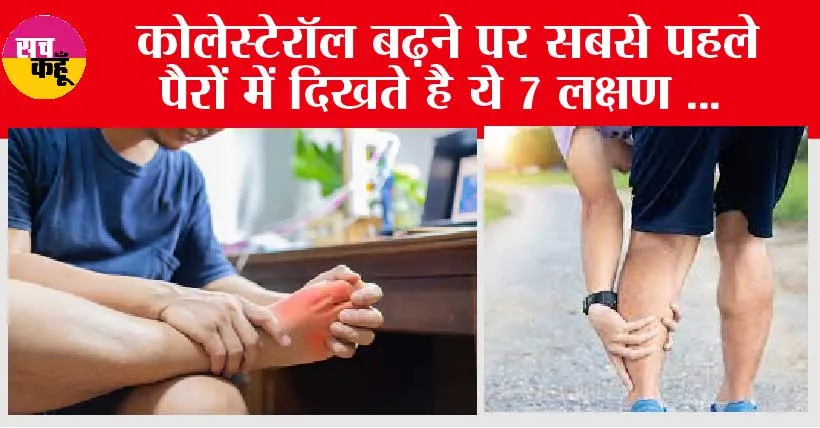 Signs of high cholesterol in legs: कोलेस्टेरॉल बढ़ने पर सबसे पहले पैरों में दिखते है 7 लक्षण …