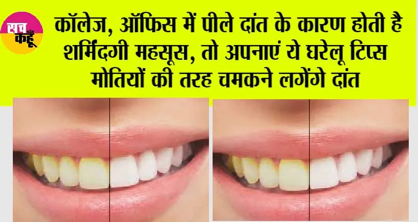 Teeth Whitening Tips: पीले दांतों से लगती है शर्मिंदगी, तो इन नुस्खों को अपनाएं और पाएं दूध जैसी सफेदी