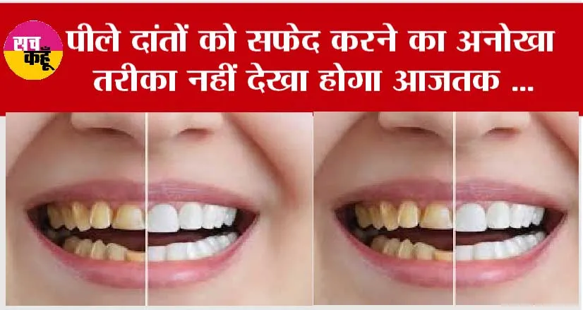 White Teeth: पीले दांतों को सफ़ेद करने का अनोखा तरीक़ा नहीं देखा होगा आजतक …