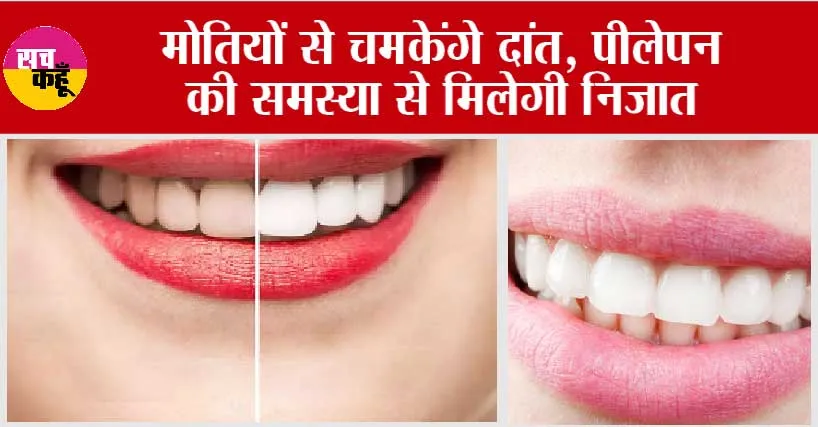 Yellow Teeth Home Remedies: मोतियों से चमकेंगे दांत, पीलेपन की समस्या से मिलेगी निजात
