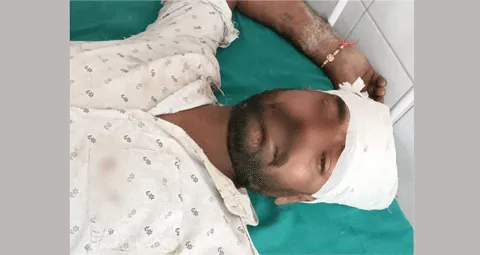 करंट लगने से मोबाइल कम्पनी का कर्मचारी घायल
