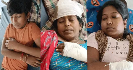 नशेड़ी युवकों ने महिला और उसके बच्चों पर कुलहाड़ी से किया हमला