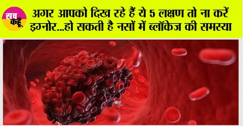 Clogged Arteries: इन 5 लक्षणों को अनदेखा न करें, ये नसों में ब्लॉकेज का संकेत दे सकते हैं