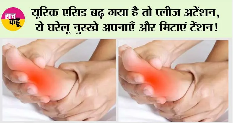 High Uric Acid: यूरिक एसिड बढ़ गया है तो प्लीज अटेंशन, ये घरेलू नुस्खे अपनाएँ और मिटाएं टेंशन!