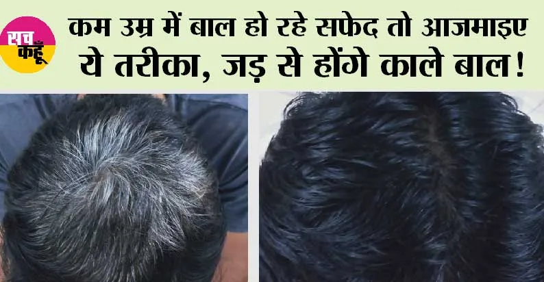 How Gray Hair Turns Black: कम उम्र में ही हो रहे हैं बाल सफेद तो परेशान ना हो, आजमाए ये तेल…