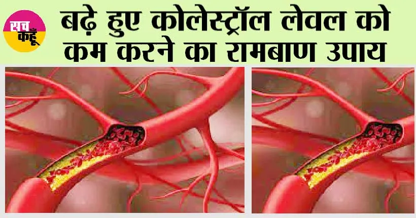 How to reduce Cholesterol: बढ़े हुए कोलेस्ट्रॉल लेवल को कैसे कम करें?