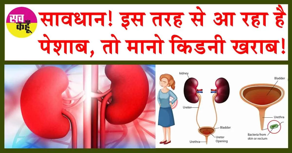 Urine symptoms of kidney disease: सावधान! इस तरह से आ रहा है पेशाब, तो मानो किडनी खराब!