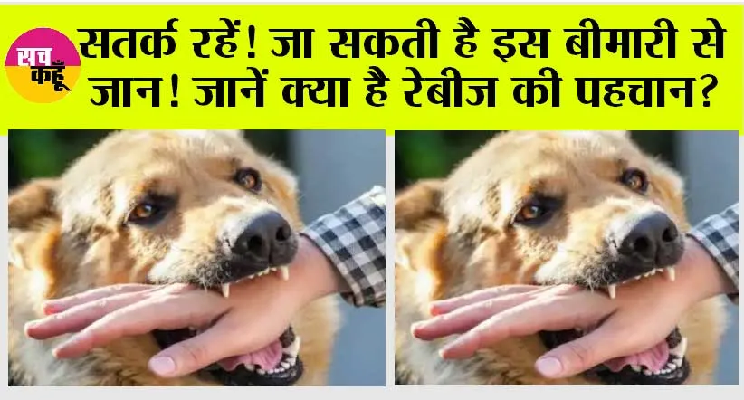 Rabies: सतर्क रहें! जा सकती है इस बीमारी से जान!