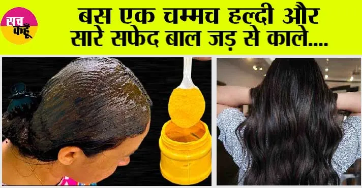 White Hair Remedy: बस एक चम्मच हल्दी और सारे सफेद बाल जड़ से काले….