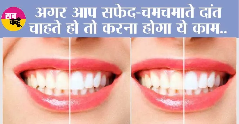 White Teeth Home Remedy: अगर आप सफेद-चमचमाते दांत चाहते हो तो करना होगा ये काम