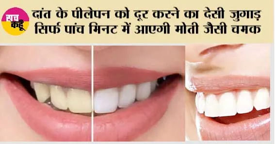 Whiten Teeth Naturally