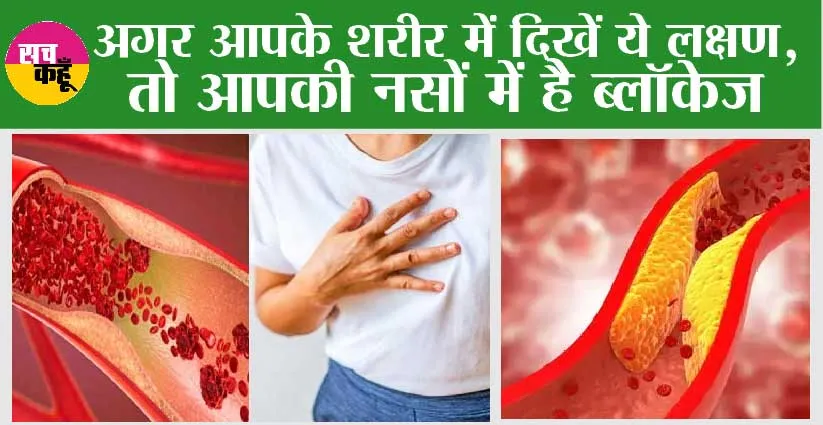 Blockage in Veins Symptoms: अगर आपके शरीर में दिखें ये लक्षण, तो आपकी नसों में है ब्लॉकेज