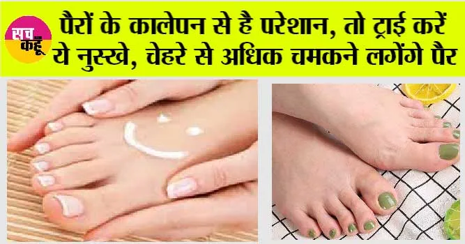 Dark Feet DIY Treatment