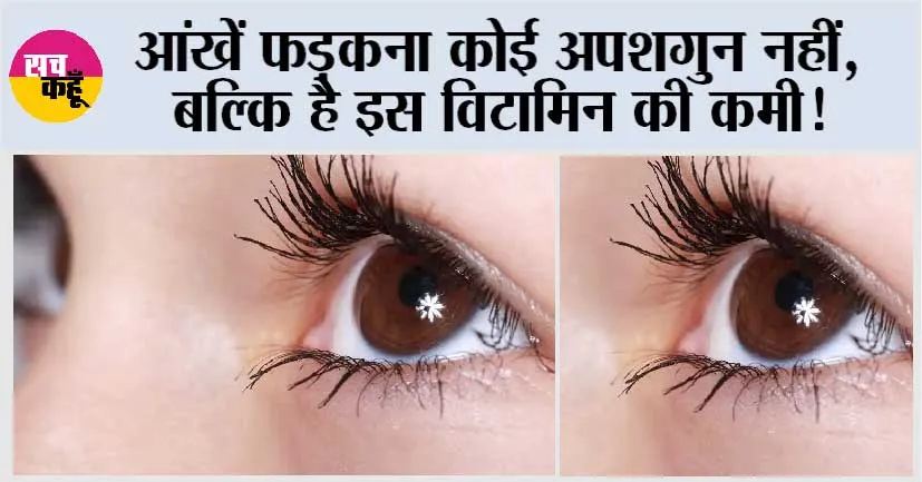 Eye twitching cause: आंखें फड़कना कोई अपशगुन नहीं, बल्कि है इस विटामिन की कमी!