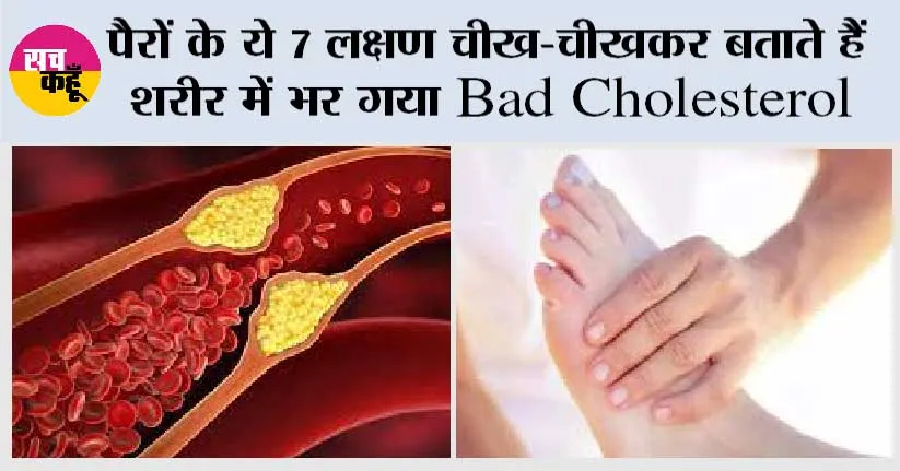 High Cholesterol Early Symptoms: पैरों के 7 लक्षण चीख-चीखकर बताते हैं शरीर में भर गया Bad Cholesterol, बिल्कुल भी ना करें इग्नोर