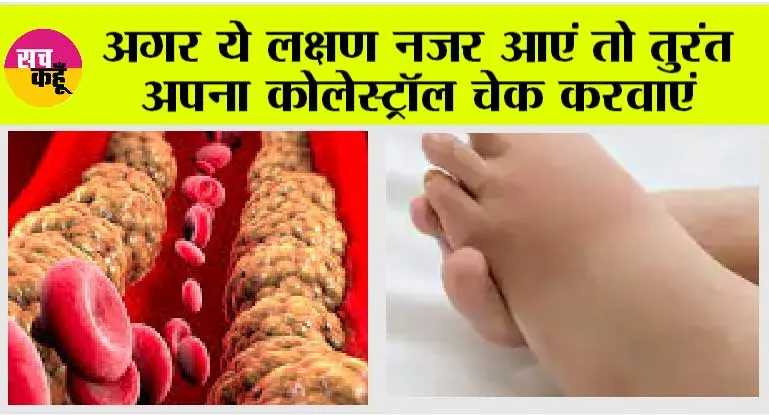 Signs your arteries full of Cholesterol: अगर ये 5 लक्षण नजर आएं तो तुरंत अपना कोलेस्ट्रॉल चेक करवाएं