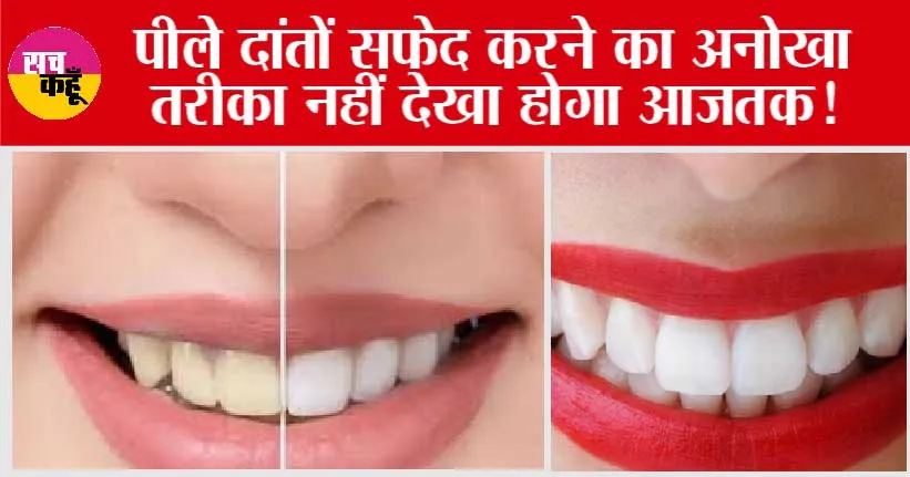 Teeth Cleaning in only 5 Minutes: पीले दांतों सफ़ेद करने का अनोखा तरीक़ा आजतक नहीं देखा होगा!