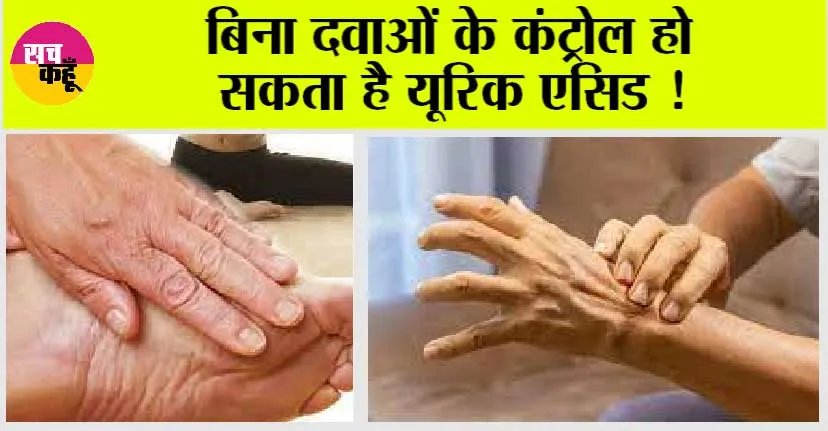 Uric Acid: बिना दवाई के ऐसे कम करें यूरिक ऐसिड
