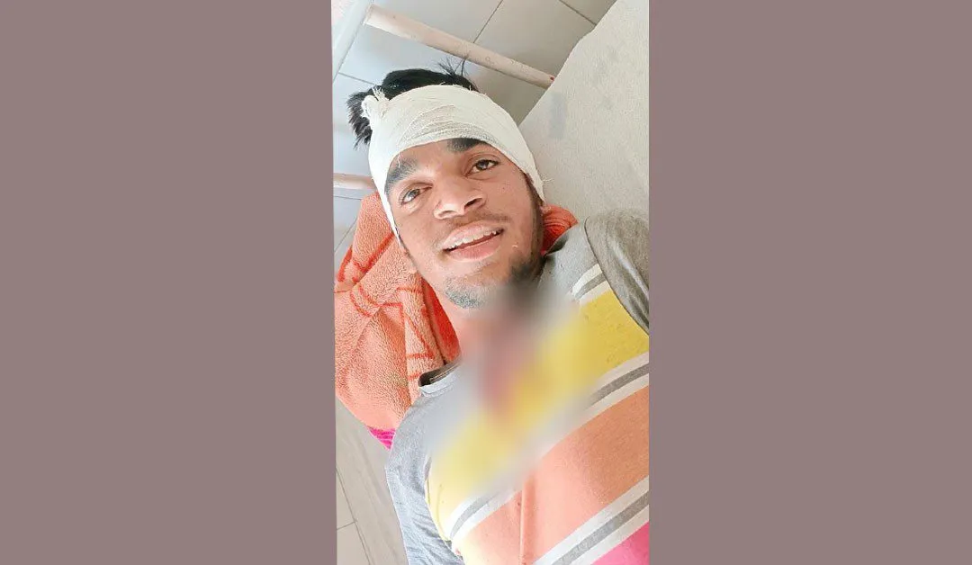 Accident: बाईक का संतुलन बिगड़ने से युवक गिरा, घायल