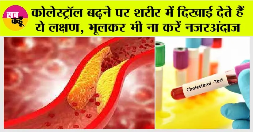 High Cholesterol Symptoms: कोलेस्ट्रॉल बढ़ने पर शरीर में दिखाई देते हैं ये लक्षण, भूलकर भी ना करें नजरअंदाज