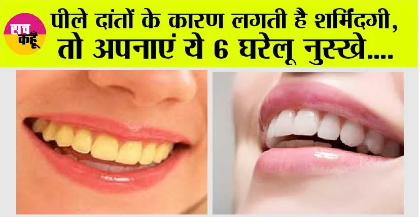 Teeth Cleaning Tips: पीले दांतों के कारण लगती है शर्मिंदगी, तो अपनाएं ये 6 घरेलू नुस्खे, दूध जैसी आ जाएगी सफेदी