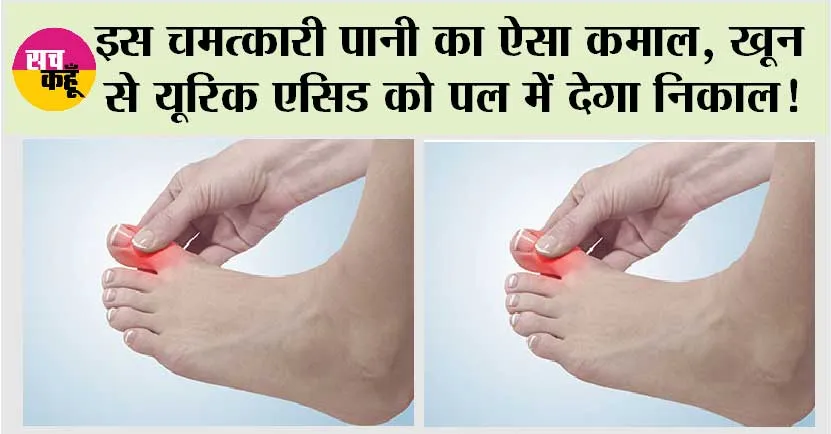 Uric Acid Control: इस चमत्कारी पानी का ऐसा कमाल, खून से यूरिक एसिड को पल में देगा निकाल!