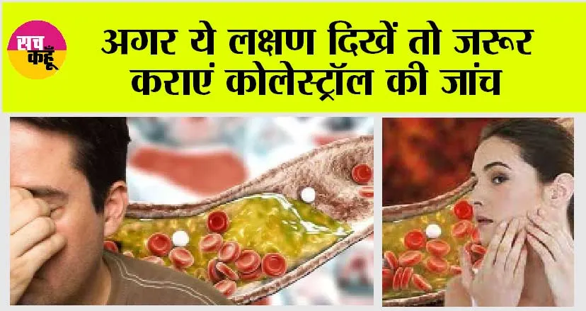 Warning Sign Of High Cholesterol