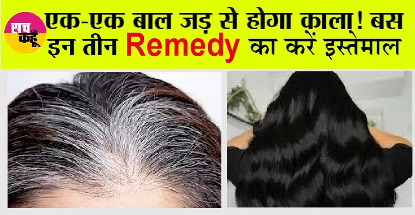 White To Black Hair: एक-एक बाल जड़ से होगा काला! बस इन तीन Remedy का करें इस्तेमाल