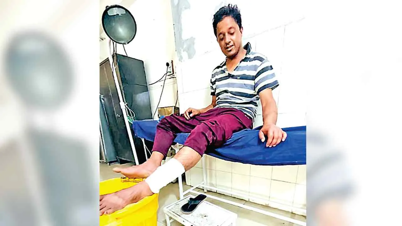 पिटबुल के हमले से व्यक्ति घायल, हाथ व पांव को नोंचा