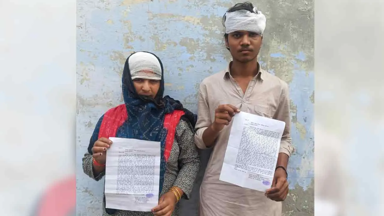बच्चों के विवाद में मारपीट कर किया घायल, एसपी से शिकायत