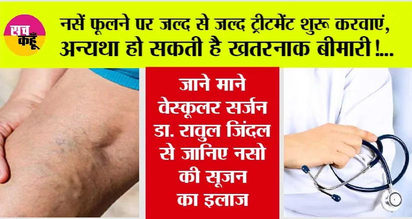 Swollen Veins: क्या फूली हुई नसें हानिकारक हैं? लक्षण, कारण और उपचार, जानें डॉक्टर की जुबानी