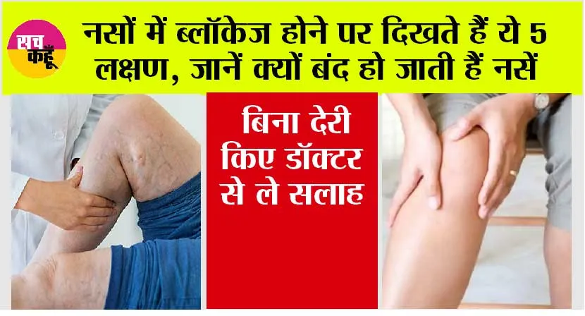 Symptoms of Veins Blockage: शरीर में दिखाई दे रहे हैं ये लक्षण, तो हो जाएं सावधान ब्लॉक हो सकती हैं नसें, बिना देरी किए डॉक्टर से ले सलाह