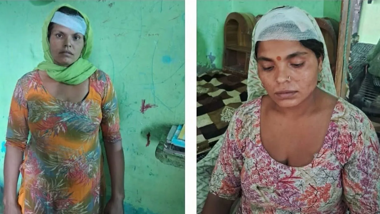 जमीन के विवाद में दबंगों ने घर में जबरन घुस कर दो महिलाओं के साथ जमकर की मार पीट, मामला दर्ज