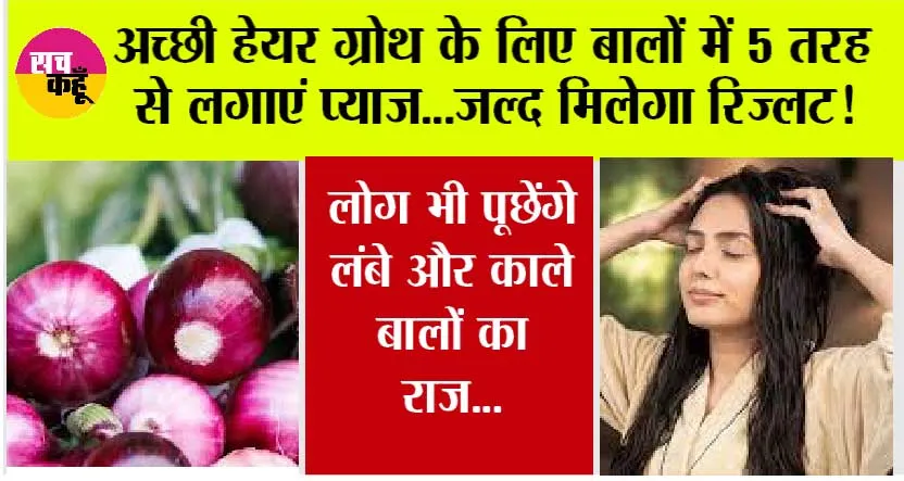 Hair Care Tips: हेयर फॉल की समस्या से है परेशान, तो इस तरह करें प्याज का इस्तेमाल, लोग भी पूछेंगे लंबे और काले बालों का राज…