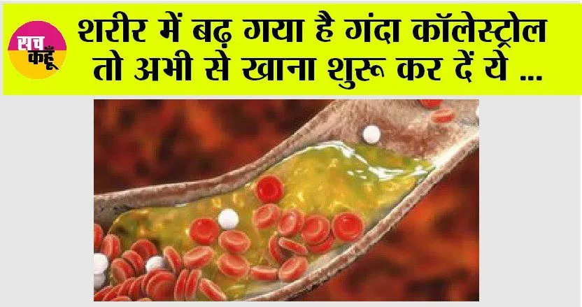 High Cholesterol Control: नसों में बैड कोलेस्ट्रॉल का जमना है जानलेवा, इन चीजों को खाकर कम कर सकते हैं कोलेस्ट्रॉल लेवल