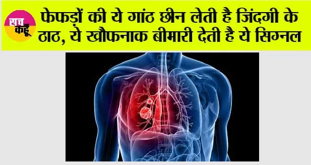 Lungs Problem: फेफड़ों की ये गांठ छीन लेती है जिंदगी के ठाठ, ये खौफनाक बीमारी देती है ये सिग्नल