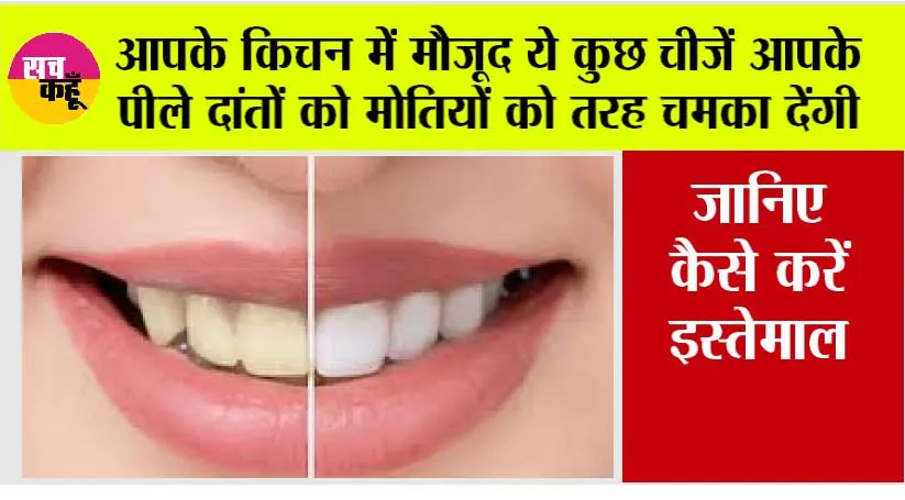 Teeth Cleaning Home Remedy: आपके किचन में मौजूद ये कुछ चीजें आपके पीले दांतों को मोतियों को तरह चमका देंगी, जानिए कैसे करें इस्तेमाल