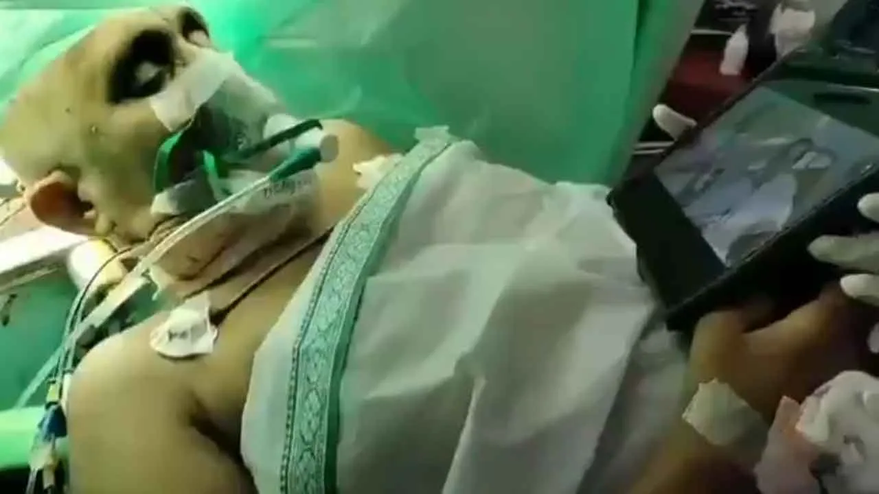 Viral Video: डॉक्टर ब्रेन सर्जरी करते रहे, महिला फिल्म देखती रही!