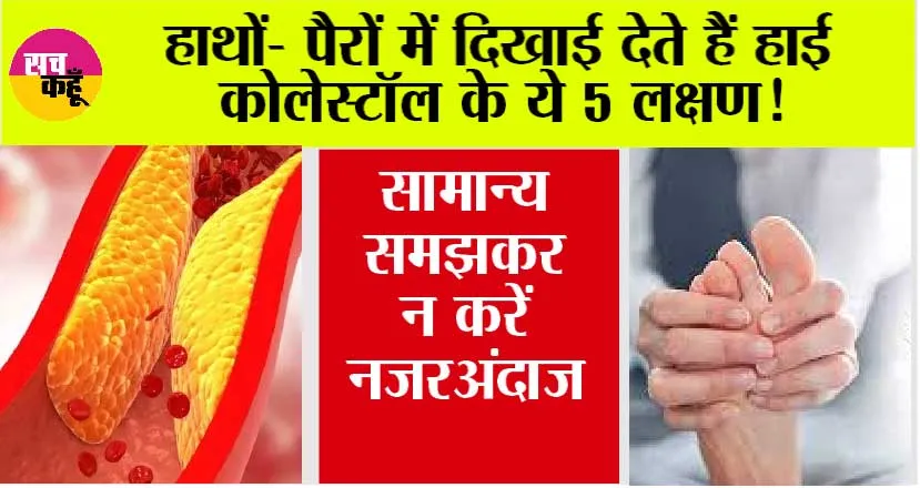 High Cholesterol Symptoms: शरीर में कोलेस्ट्रॉल बढ़ने पर हाथ-पैरों में नजर आते हैं ये लक्षण, इसे न करें नजरअंदाज, वरना…