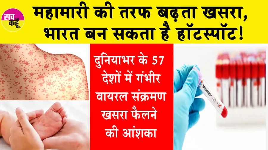 Measles Disease: महामारी की तरफ बढ़ता खसरा, भारत बन सकता है हॉटस्पॉट!